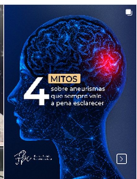 Aneurysm myths educational post